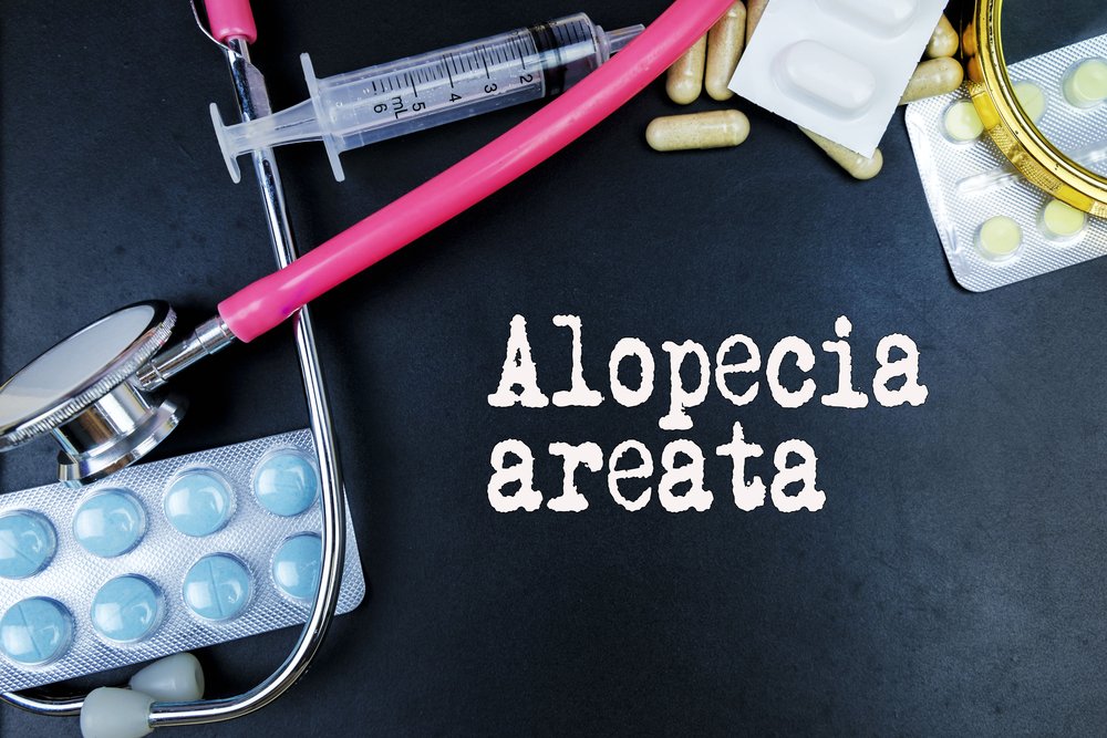 explore alopecia areata self-care steps