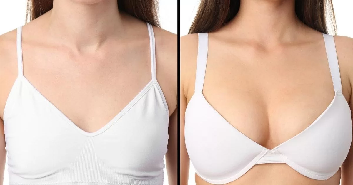 Breast Augmentation Before and After Results: What Dubai Patients Need to Know