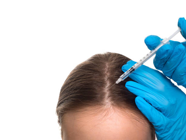 Revitalize Your Hair with PRP Treatment in Islamabad