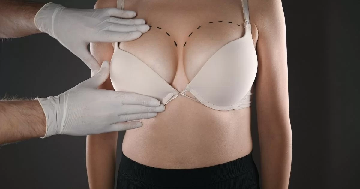 Preparing for Your First Appointment with the Best Breast Augmentation Surgeons in Dubai