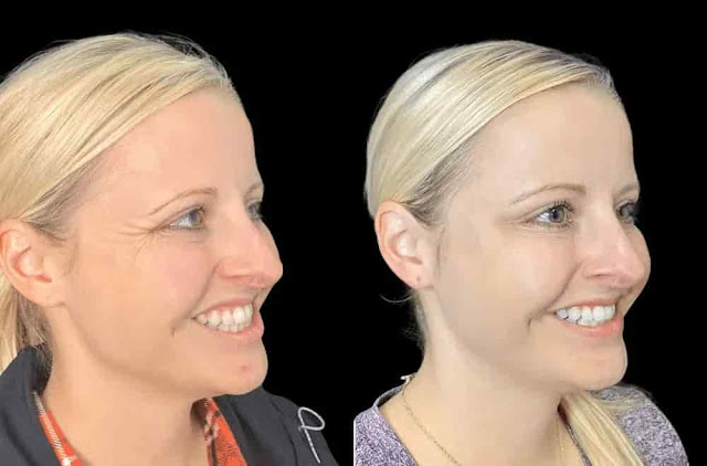 The Best Plastic Surgeon in Dubai for Botox Shares Aesthetic Insights