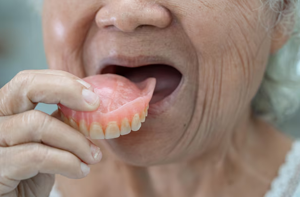 dentures columbia sc