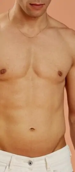 HD Liposuction: The Modern Solution for Sculpted, Athletic-Looking Bodies