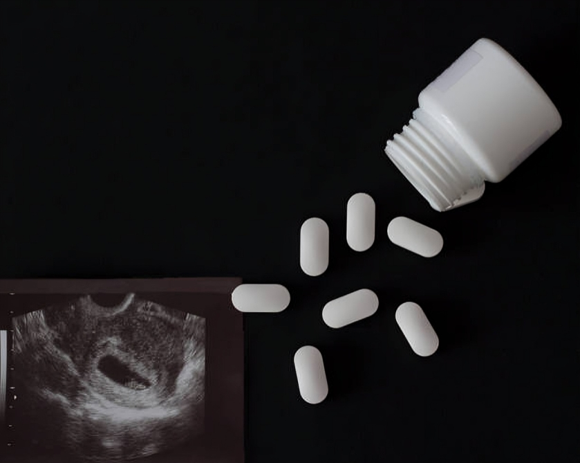 abortion pill reversal