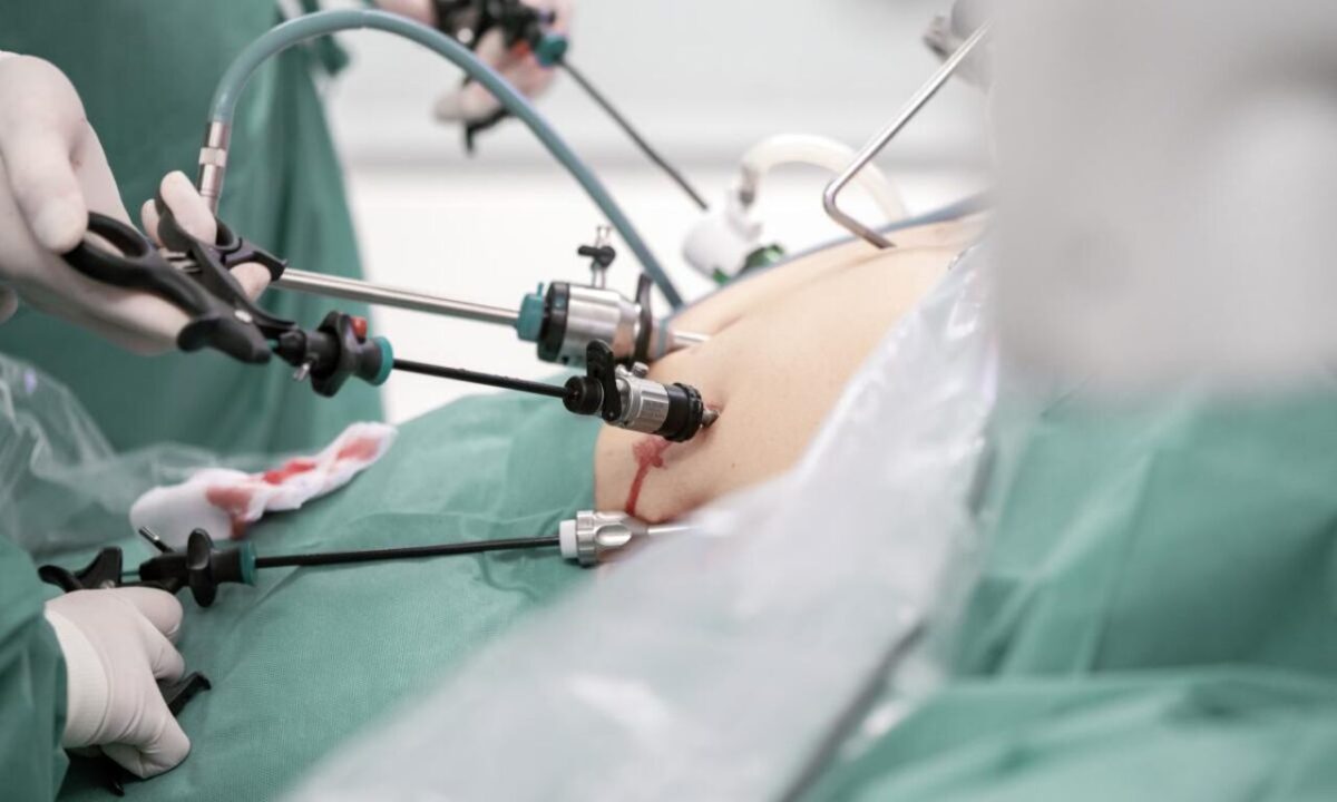 Bariatric Surgery in islamabad