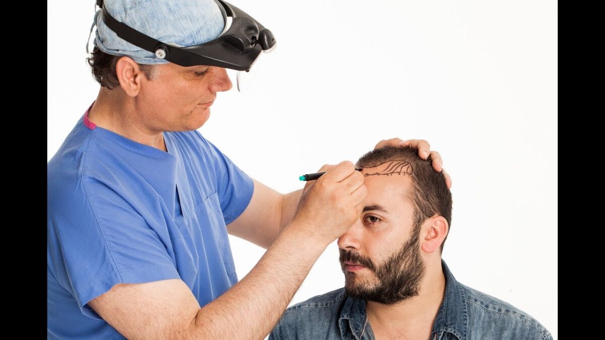 Hair Transplant in Dubai