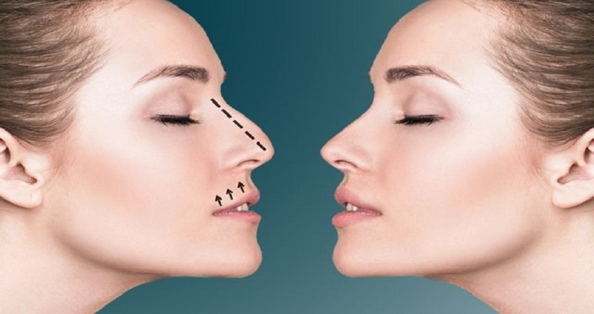 عملية تجميل الأنف في الرياض