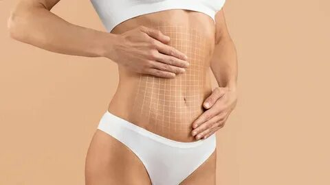 Tubeless Tummy Tuck NYC: A Modern Approach to a Flatter Stomach
