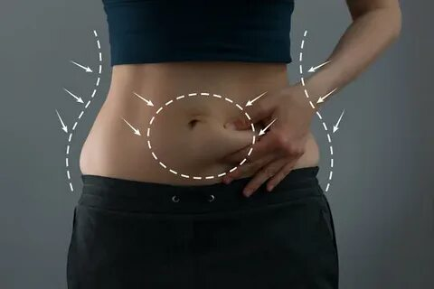 Top Tubeless Tummy Tuck Surgeons in New York