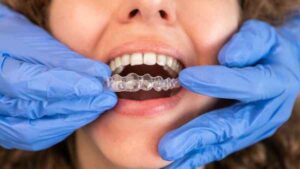 invisalign Leominster