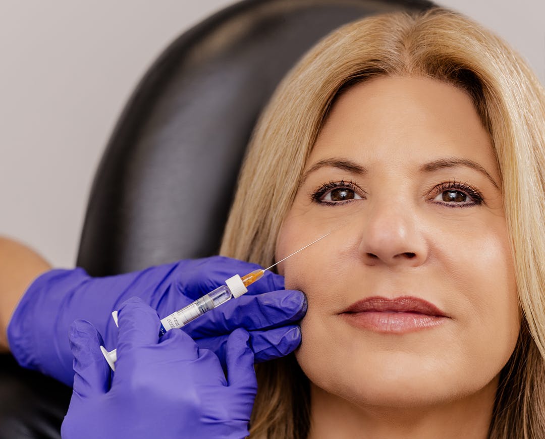 Under Eye Fillers in Dubai