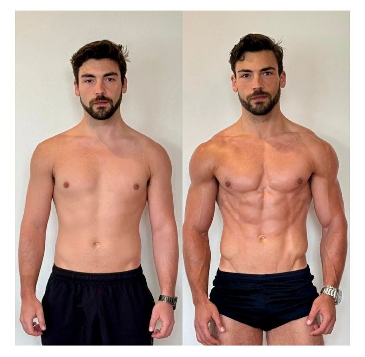 Gynecomastia Surgery in Riyadh