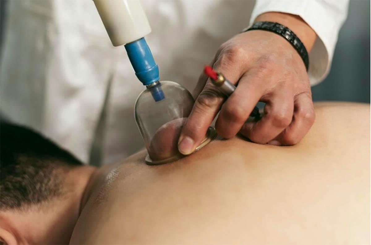 Hijama in Dubai