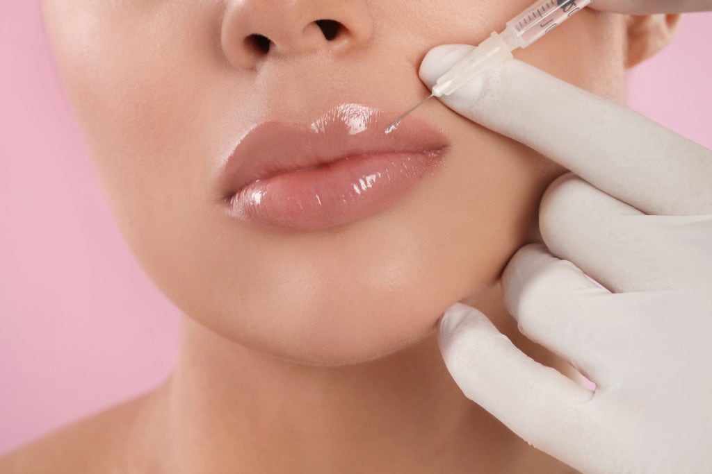 How Much Filler Is Needed for a Fuller Lip Look?