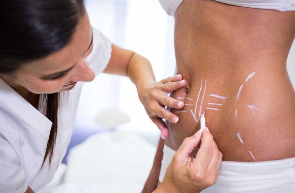 Liposculpture in Islamabad