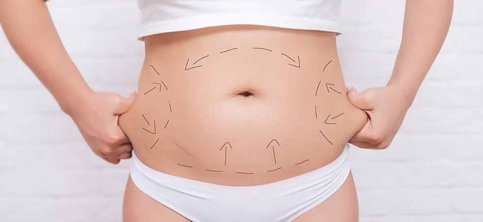 Tummy tuck cost Islamabad