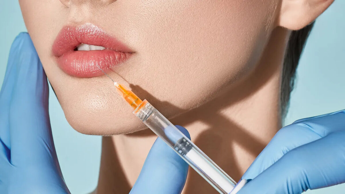 Best Lip Fillers Injections in Dubai