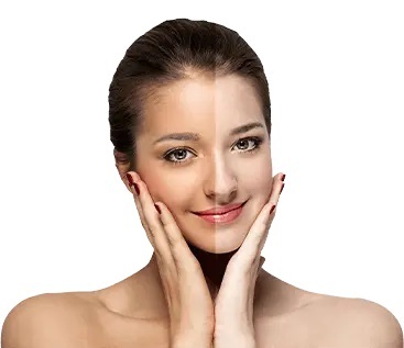 skin whitening in Pakistan