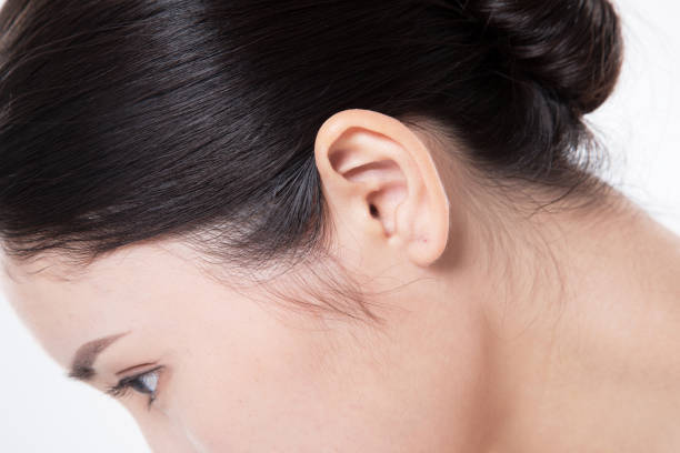 Otoplasty in Riyadh