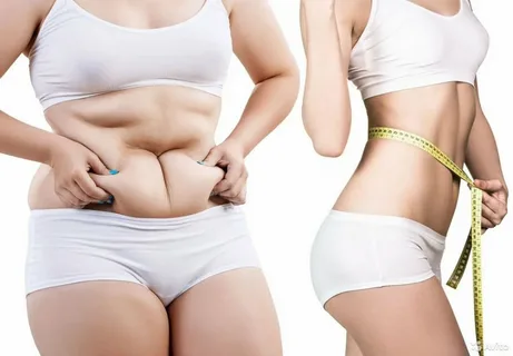 Tummy Tuck Surgery in riyadh