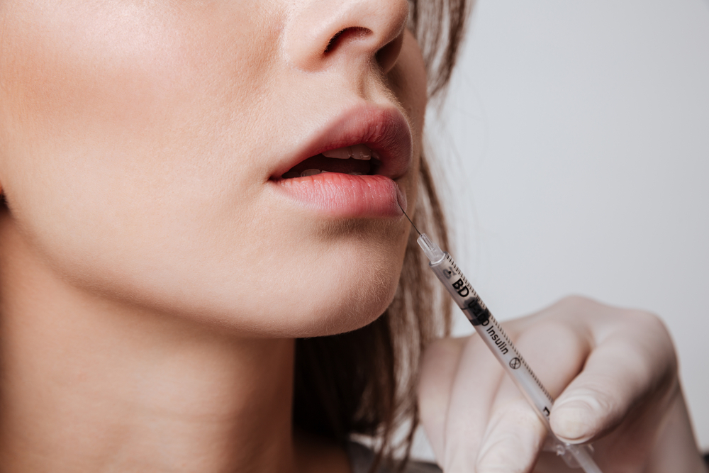 Best Lip Fillers Injections in Dubai