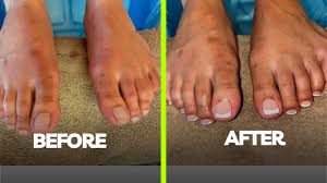 difference between manicure and pedicure