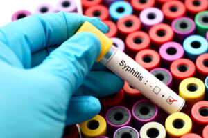 STD test in Dubai