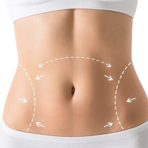 Tummy Tuck in Riyadh