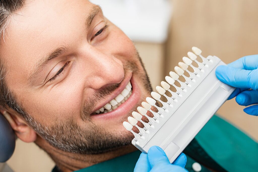 dental veneers in Toronto