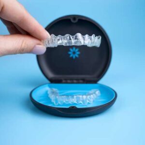 Invisalign Cost in Hyderabad