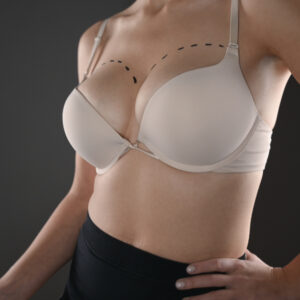 Breast Augmentation in Islamabad