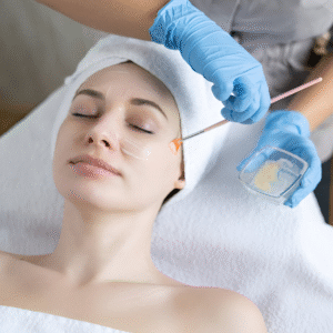 chemical peel in Islamabad