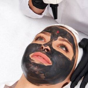 Carbon Facial in Islamabad 