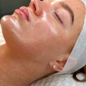 Deep Skin Cleansing in Riyadh