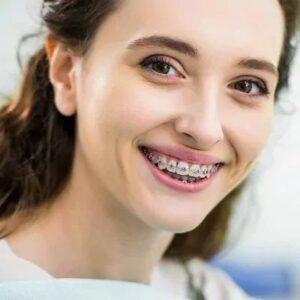 Dental Braces in Islamabad