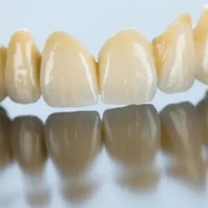 How Dental Crowns and Bridges Can Restore Your Teeth and Confidence
