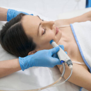 Hydrafacial for Acne-Prone Skin