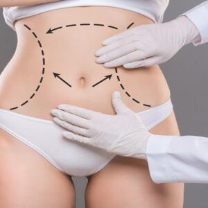 شفط الدهون في الرياض