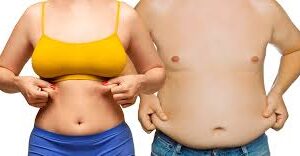 Liposuction in Islamabad