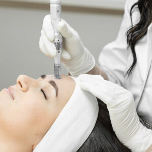 Microneedling Treatment in Islamabad
