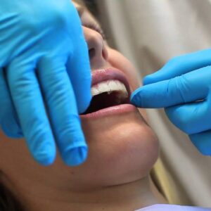 Teeth Whitening Strips in Islamabad