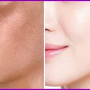 Which Treatment is Good for Skin Whitening