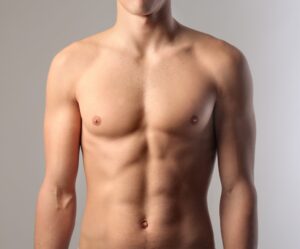 Gynecomastia in Dubai