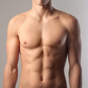 Gynecomastia in Dubai
