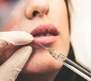 حقن الشفاه في الرياض