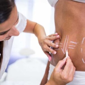 Body Contouring in Islamabad