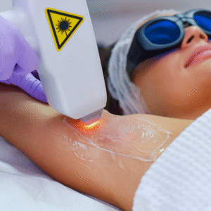 Can Laser Hair Removal Remove Hair Permanently