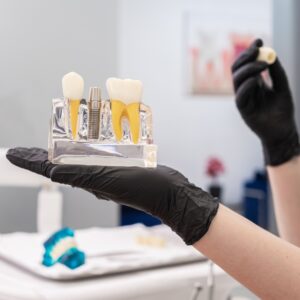 Dental Implants in Oakville, ON