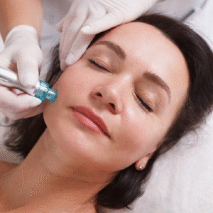 HydraFacial for Acne-Prone Skin Real Results
