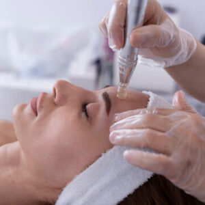 Microneedling Treatment in Islamabad
